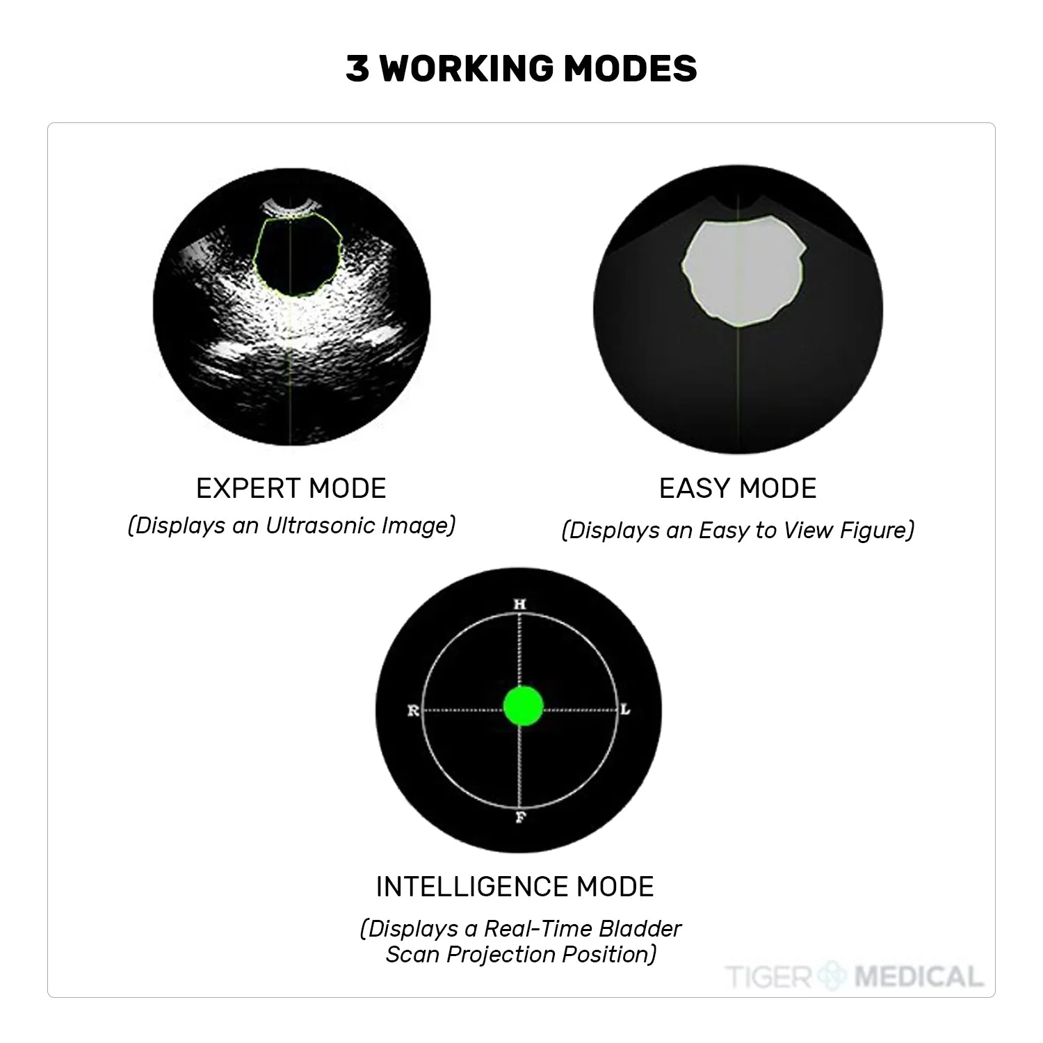 Peaksonic M2 Touchscreen 3D Bladder Scanner